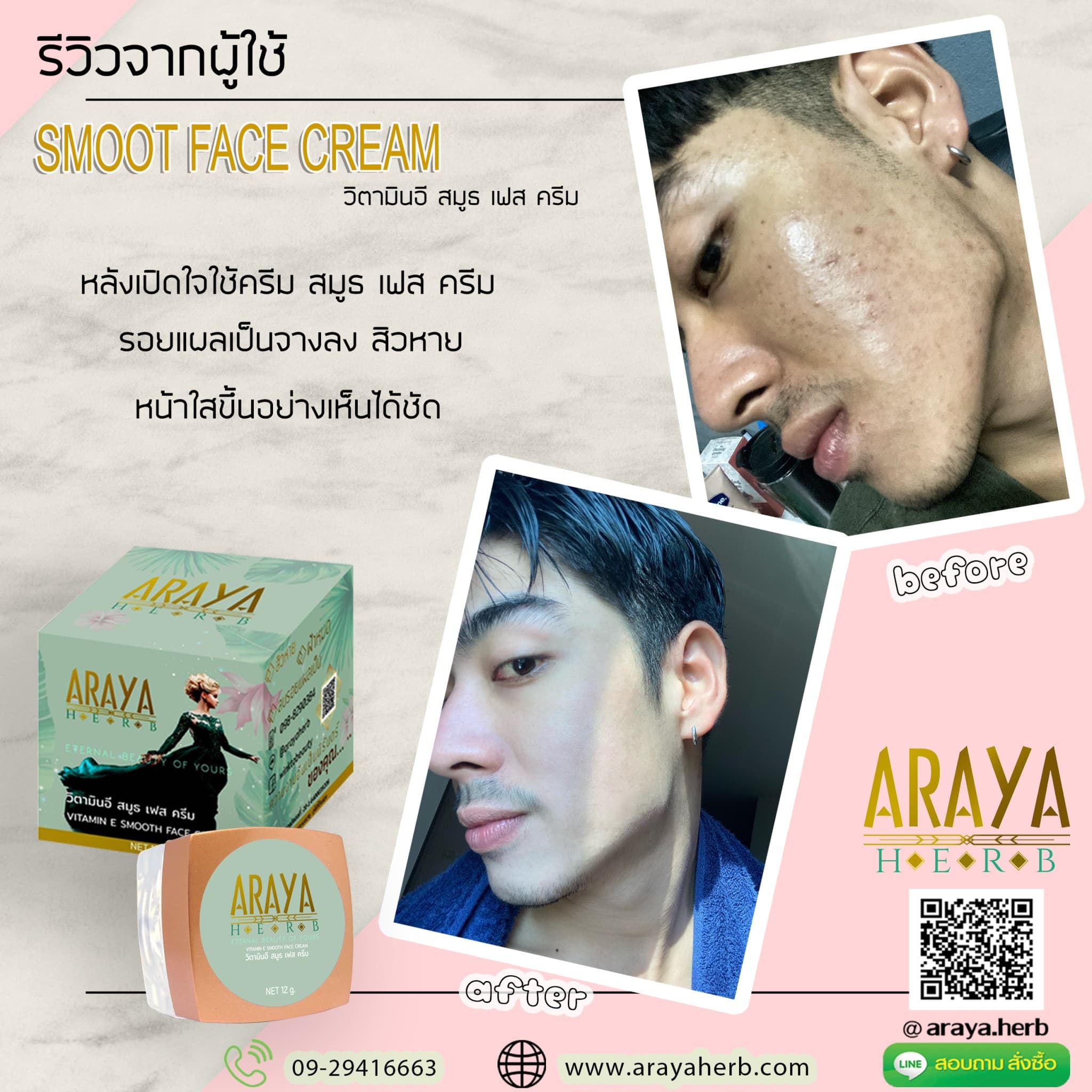 before after Araya Herb