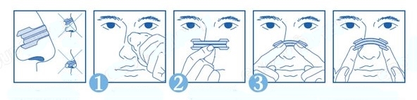 HE-062 NOSE PLASTER พลาสเตอร์ติดจมูกช่วยหายใจได้สะดวก ลดการนอนกรน ช่วยให้หลับสนิท