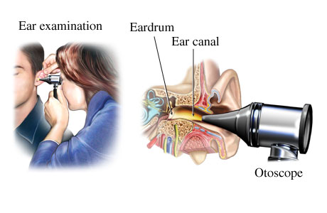 HE-084 otoscope อุปกรณ์ช่วยในการตรวจช่องหู แบบพกพา ตรวจหาการติดเชื้อ