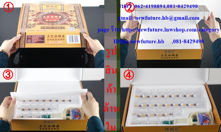 HE-0108ถ้วยดูดสุญญากาศรักษาโรค ครอบแก้วสุญญากาศรรักษาโรค (Vacuum Cupping) 24ถ้วย แผ่นกัวซา น้ำมันกัวซา