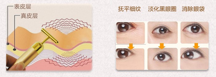 HE-033เครื่องนวดหน้าทองคำ 24K Gold Plated Energy T-Shape เครื่องยกกระชับใบหน้าให้หน้าเรียว ไร้ริ้วรอย ไร้ตีนกา