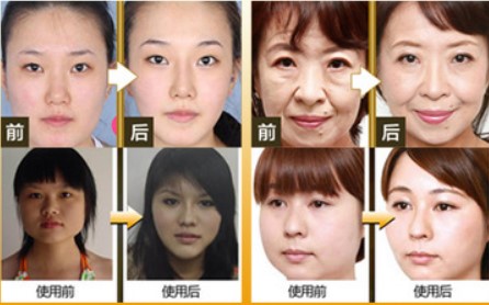 HE-033เครื่องนวดหน้าทองคำ 24K Gold Plated Energy T-Shape เครื่องยกกระชับใบหน้าให้หน้าเรียว ไร้ริ้วรอย ไร้ตีนกา