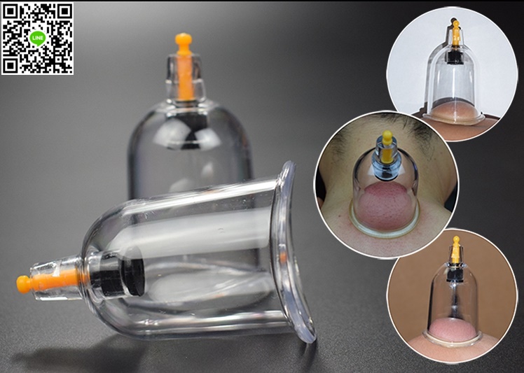 HE-110ถ้วยดูดสุญญากาศรักษาโรค ครอบแก้วสุญญากาศรรักษาโรค (Vacuum Cupping) แบบ24ถ้วย