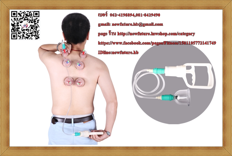HE-081ถ้วยดูดสุญญากาศรักษาโรค ครอบแก้วสุญญากาศรรักษาโรค (Vacuum Cupping) 12ถ้วย กัวซา